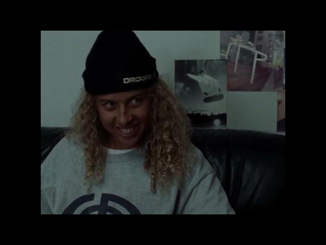 Mid90s (2018) Stevie gets his Nickname sunburn