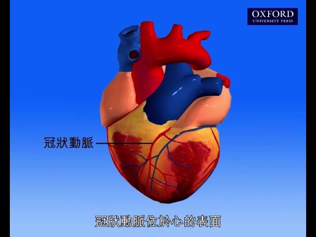 動畫22.2 冠心病的成因