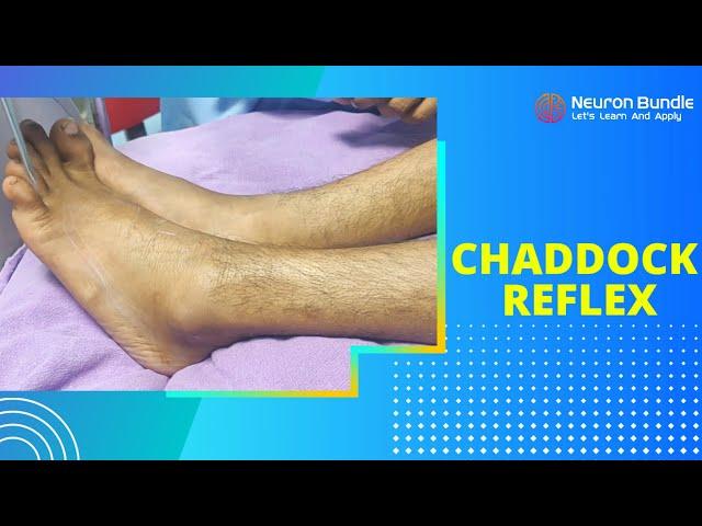 chaddock reflex | an alternative to babinski sign  | corticospinal tract lesion #neurology