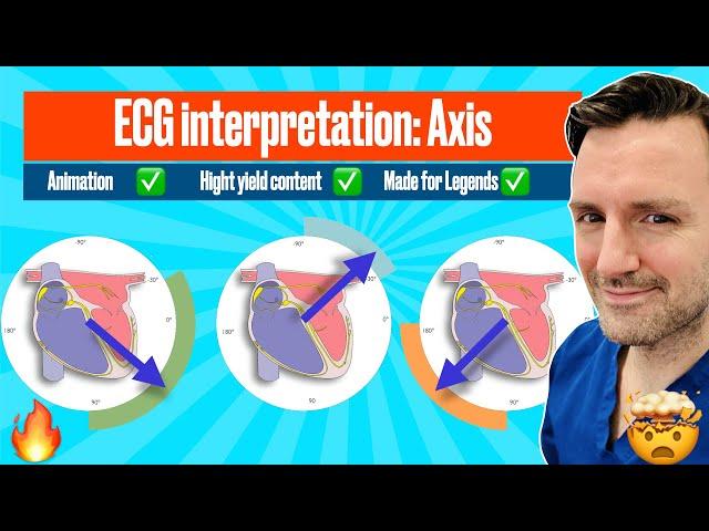 Cardiac Axis! A visual guide