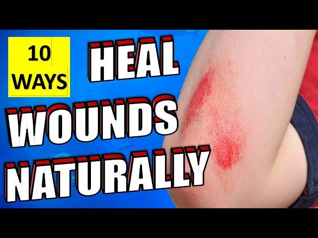 10 Natural Ways To Heal Wounds And Scrapes Fast & Quickly