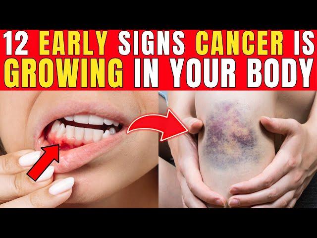 12 Early Cancer Signs You Can’t Ignore!| Healthy Care