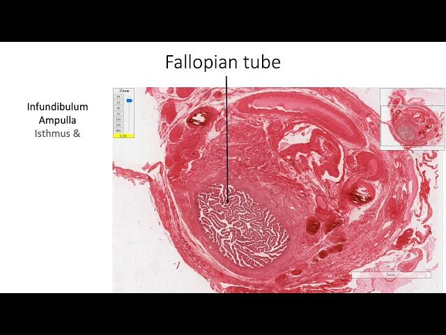 Histology with Chimmalgi: Fallopian Tube