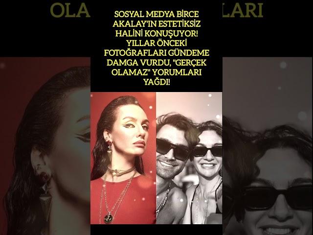 BİRCE AKALAY'IN ESTETİKSİZ HALİ SOSYAL MEDYADA GÜNDEM OLDU!