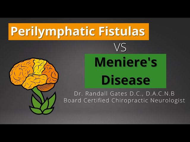 Perilymphatic Fistulas vs Meniere's Disease