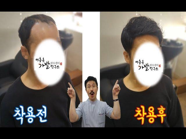 30대 남자 부분가발 후기! 정수리탈모 M자탈모가 진행되면서 부분 가발착용 Before and after wearing wigs. hair loss end!