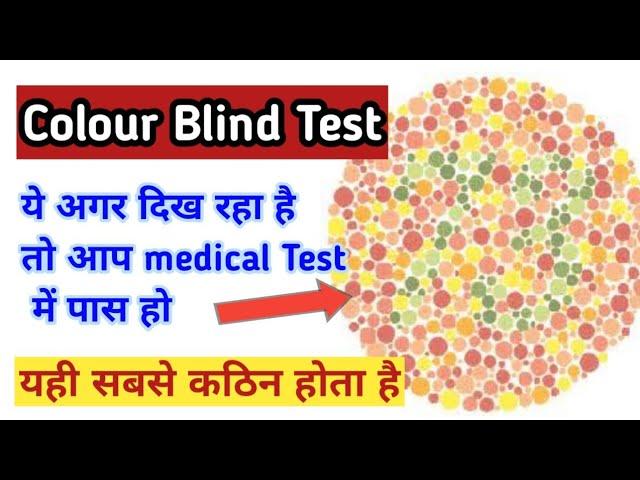 up police medical test video, upp medical test date,up police bharti 2021 medical kaise hoga,upp