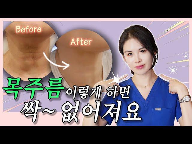 자글자글한 목주름 없애는 방법 ! 홈케어부터 새로 나온 시술까지 