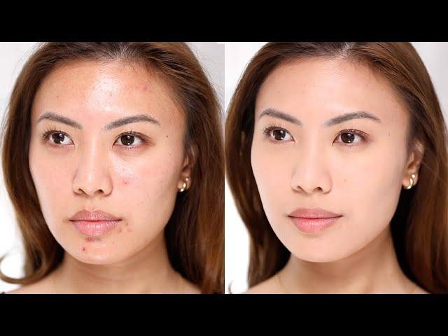 How to cover acne *NO FOUNDATION MAKEUP*