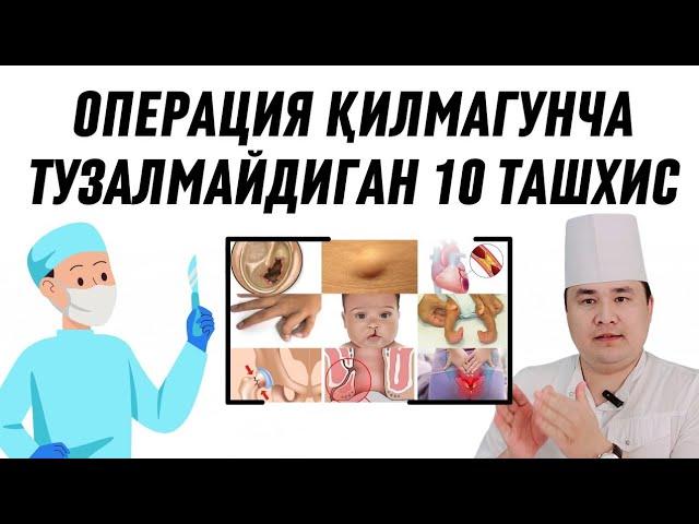 ОПЕРАЦИЯ ҚИЛИШ ШАРТ БЎЛГАН 10 ТАШХИС ҲАҚИДА ИСЧАНОВ МАЪЛУМОТИ