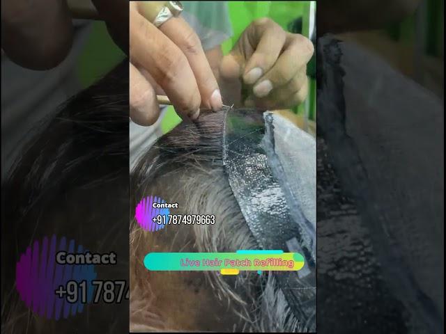  Refilling Hair Patch | ORIGINAL HUMAN HAIR | Call Us 7874979663   #hairpatch