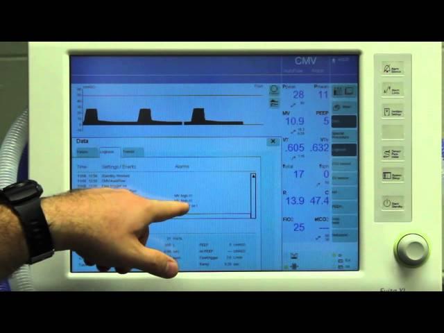 Ventilator Student Video