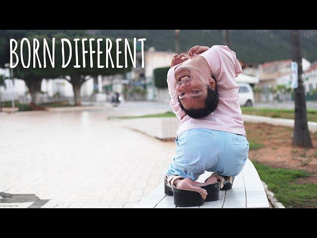 The Man With The Upside Down Head | BORN DIFFERENT