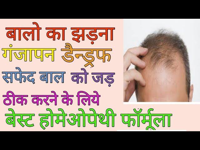 HAIR FALL-REASONS AND HOMEOPATHIC TREATMENT AND SOLUTIONS BY DR SACHIN TOMAR