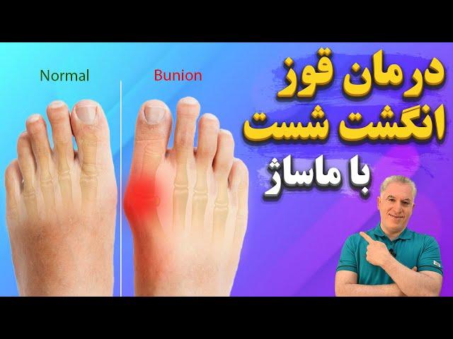 چگونه با 4 حرکت و ماساژ موثر خانگی قوز شست پا را درمان کنیم؟