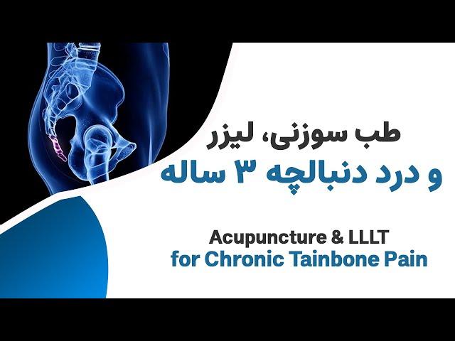 درد دنبالچه سه ساله و طب سوزنی- Laser Acupuncture for tailbone pain
