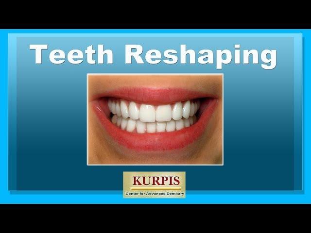 Teeth Reshaping