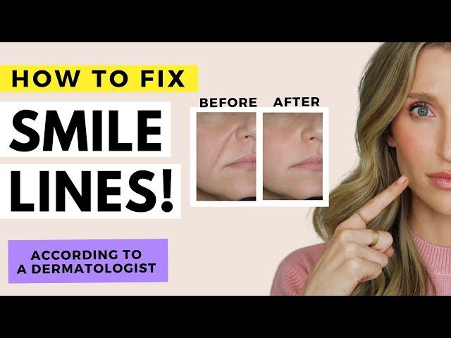 How to Fix Wrinkles Around the Mouth | Smile Lines and Sagging Skin | Dr. Sam Ellis