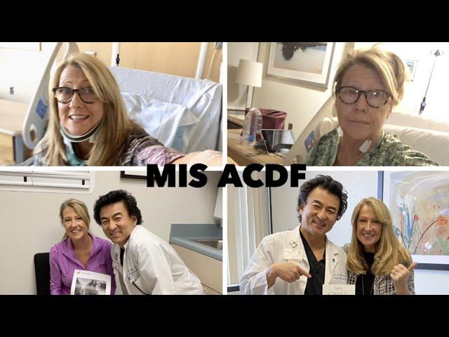 1 Year Recovery After ACDF Surgery - Start to Finish