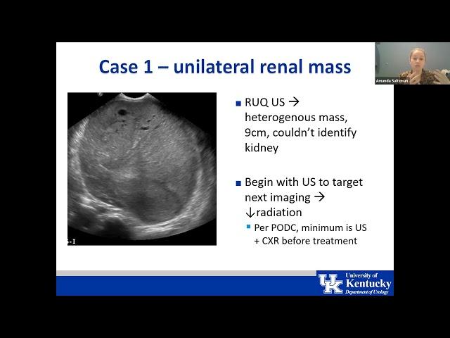 IVUmed VVP: Pediatric Urologic Oncology