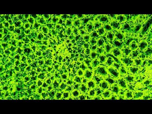 DIY fluorescence microscopy - HE stained mouse kidney tubules (eosin fluorescence), 488nm excitation