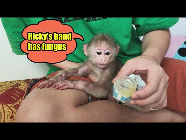 Dad applies nail fungus medicine to baby monkey Ricky