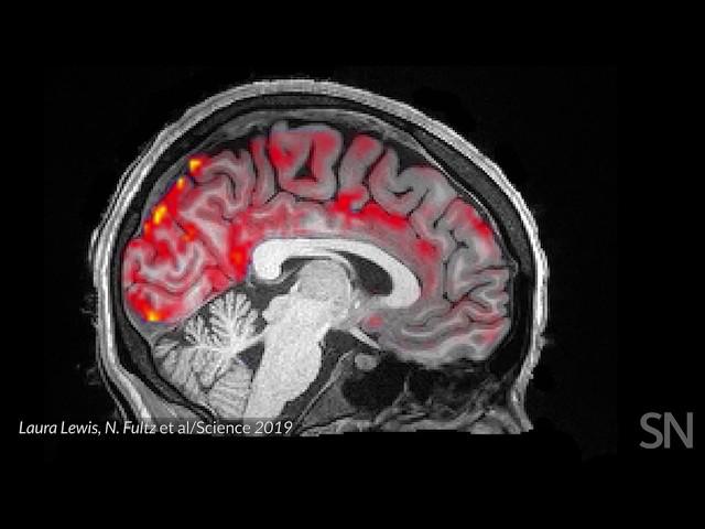Blood flows out and cerebrospinal fluid flows into the sleeping brain  | Science News
