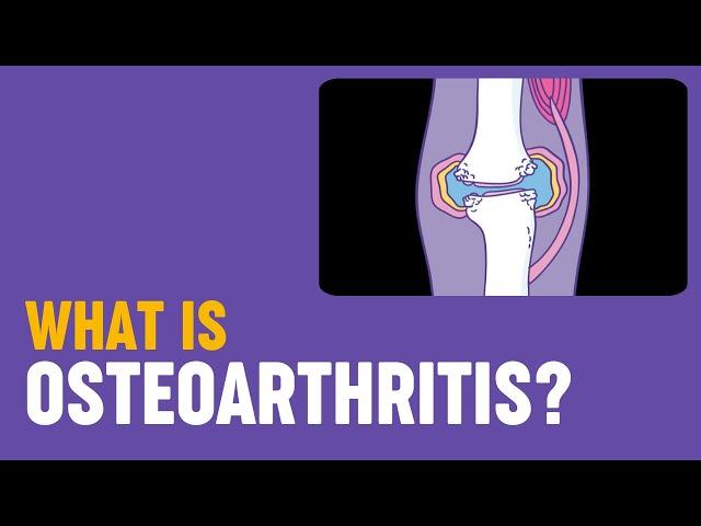 What is osteoarthritis?