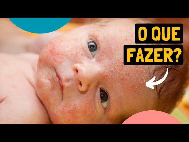 Primeiros Dias do Bebê Recém-nascido: 6 Situações Estranhas que Assustam