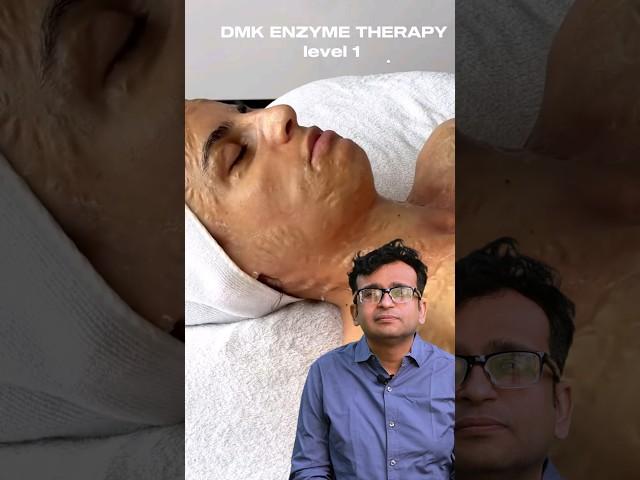 This is an enzyme mask therapy.