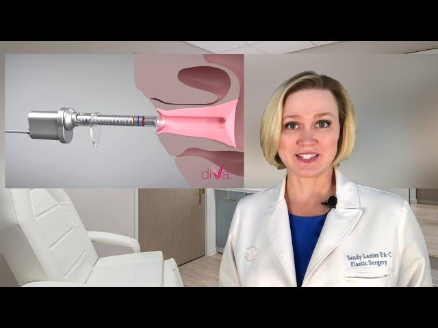 diVa® Laser: Noninvasive Vaginal Rejuvenation