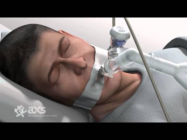 AXS Studio medical device animation drug delivery