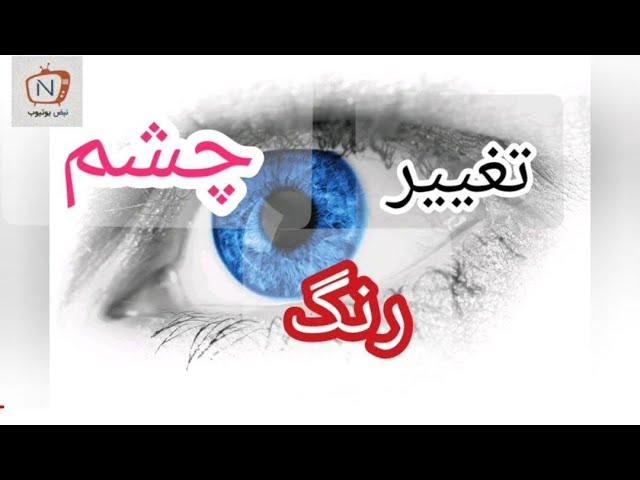 بیوکنزی تغییر رنگ چشم به آبی