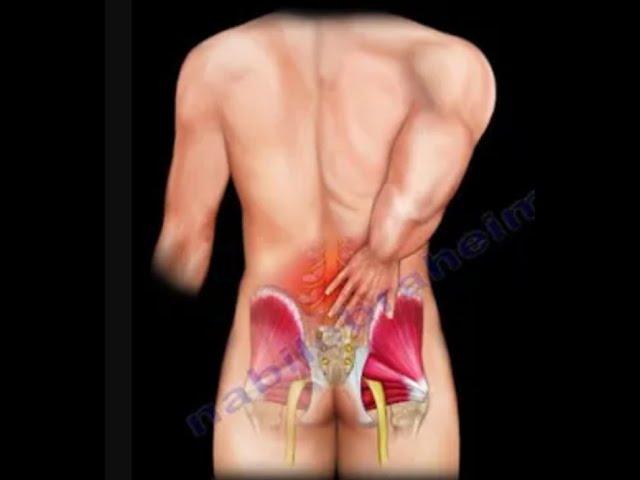 Low Back Pain, causes, diagnosis and treatment.