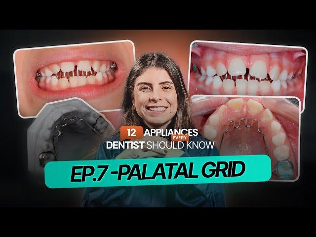 EP.7: Definitive solution for OPEN BITE?