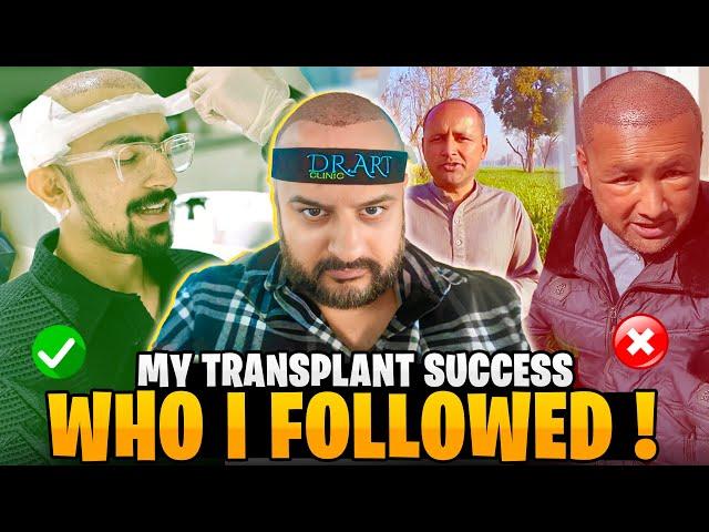 Hair Transplnat Post Operation Care Tips | Who I followed Rana Hamza or Mubashir Siddiqui