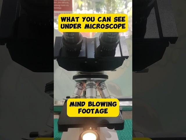 Mengerikan!!! Begini Penampakan Scabies dan Jamur pada Hewan.#vet #animals #microscope #study