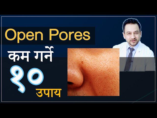 OPEN PORES को उपचार । घरेलु उपचार । Home treatment