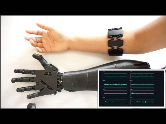 Myoelectric Control