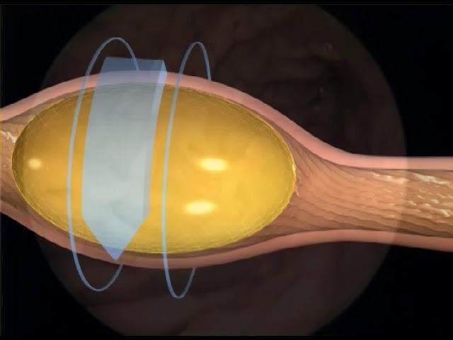 Virtual Chicken: Part 1: The Female Reproductive Tract