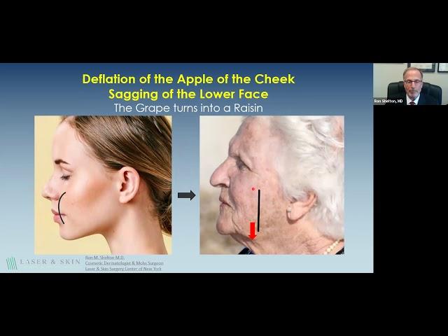 The Best Ways to Tighten Your Skin Without Surgery | LSSCNY Webinar