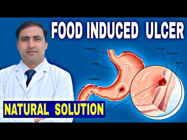 FOOD INDUCED ULCER || NATURAL SOLUTION || Dr Kumar education clinic