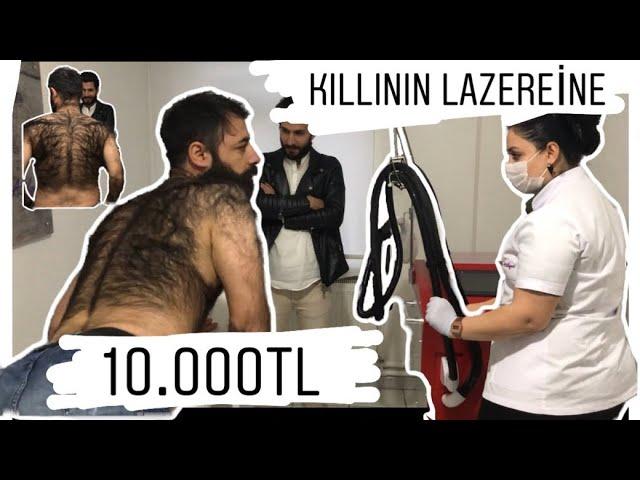 DÜNYANIN EN KILLI ADAMINA LAZER YAPTIRMAK!!!