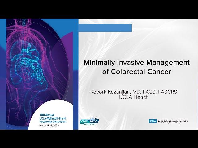 Minimally Invasive Management of Colorectal Cancer | UCLA Digestive Diseases