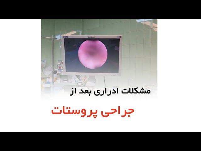 مشکلات ادراری بعد از جراحی پروستات _ دکتر سید امین میرصادقی