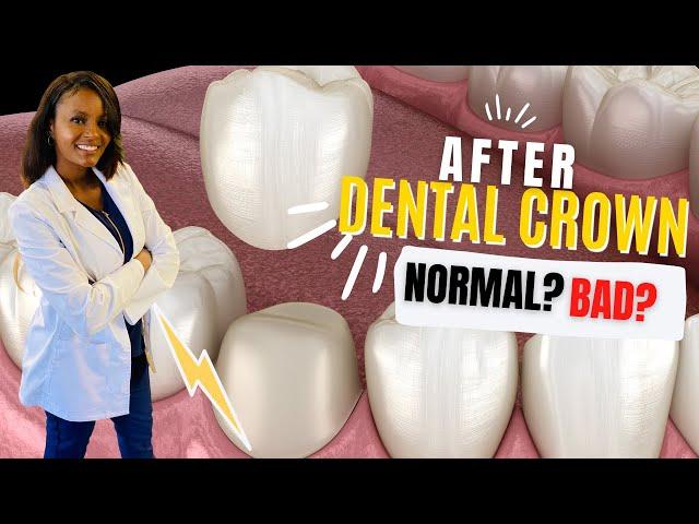 What is Normal after Starting a Dental Crown? Pain, Sensitivity should you worry?