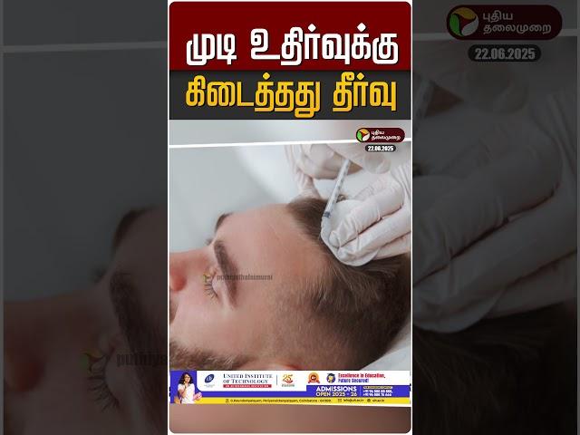 முடி உதிர்வுக்கு.. கிடைத்தது தீர்வு | Hair Fall Treatment