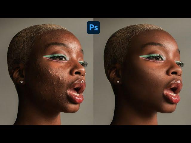 High-End Skin Retouching Beginner Photoshop Tutorial | Cleansing the face #photoshop