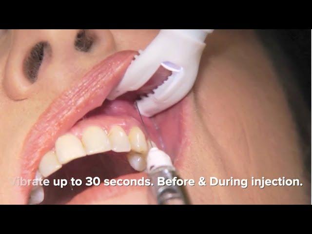 DentalVibe. How it works, a general instructional video