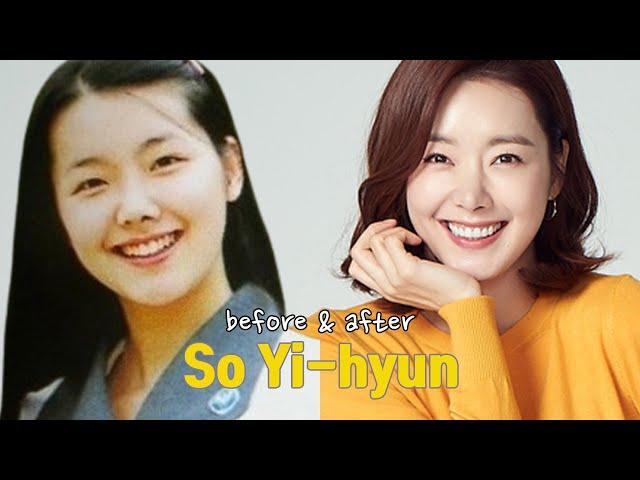 So Yi-hyun before and after